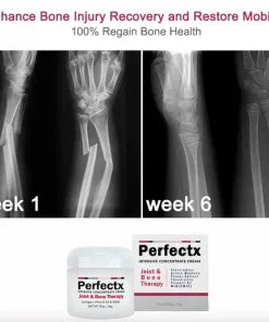PERFECTX JOINT AND BONE THERAPY CREAM ( Made In USA )