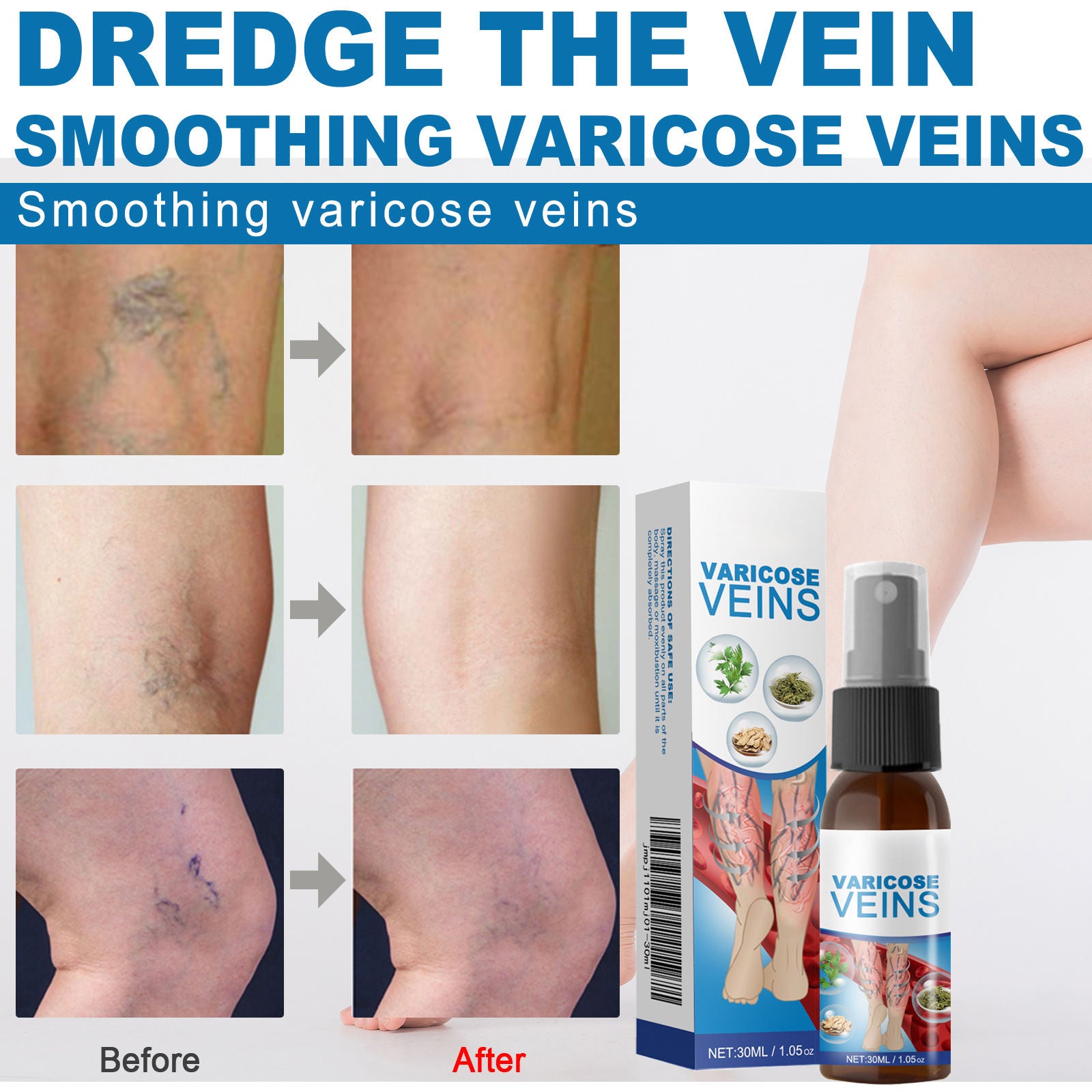 South Moon Varicose Veins Spray